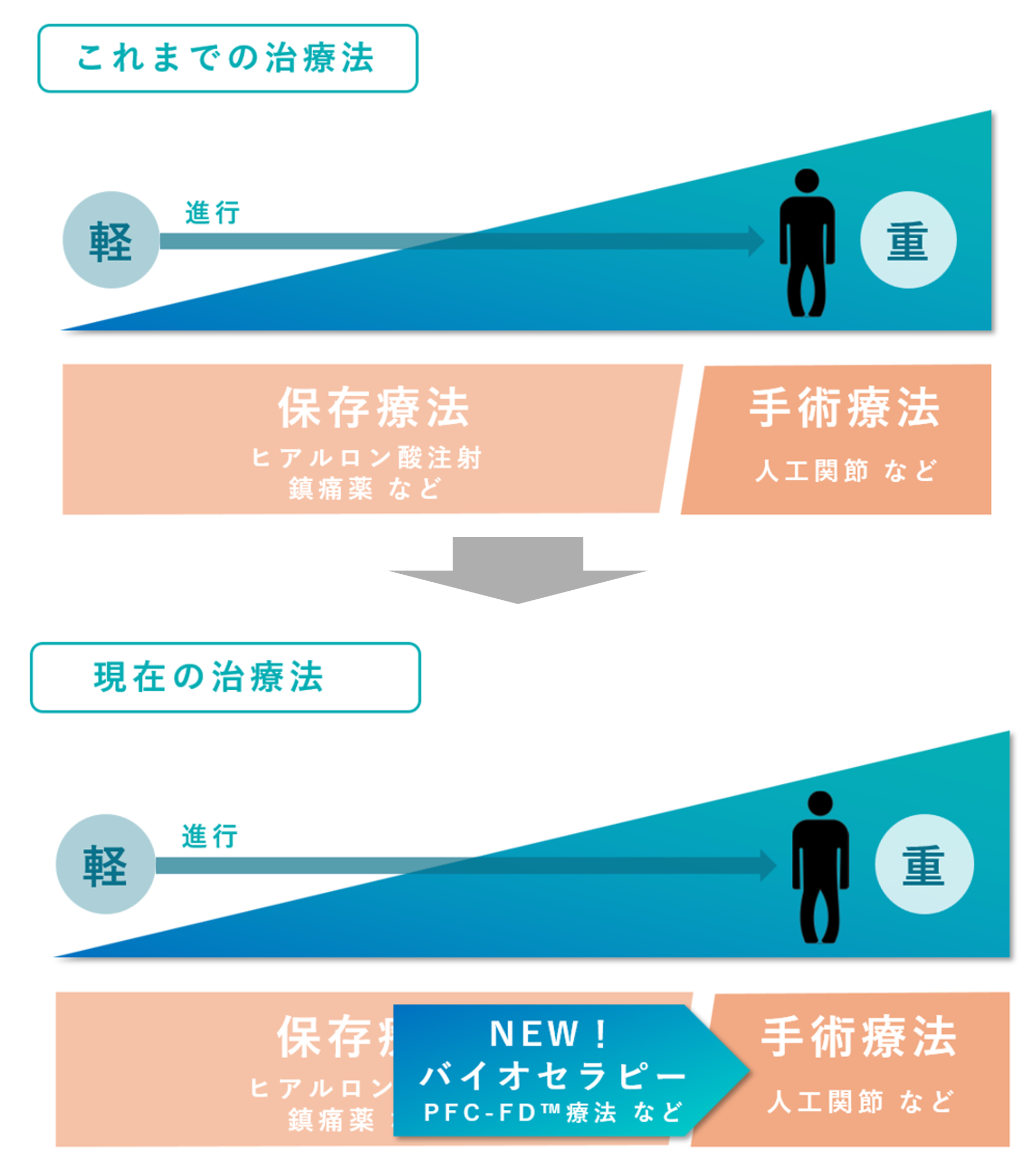 関節治療における「これまでの治療法」と「現在の治療法」を比較した図解です。 以前は、症状が軽い時期の「保存療法(ヒアルロン酸注射や鎮痛薬)」から、重症化した際の「手術療法(人工関節)」へ移行するのが一般的でした。 しかし現在は、その中間的な選択肢として「バイオセラピー(PFC-FD™ 療法など)」が新しい治療法として加わり、より幅広い進行度に対応できるようになりました。