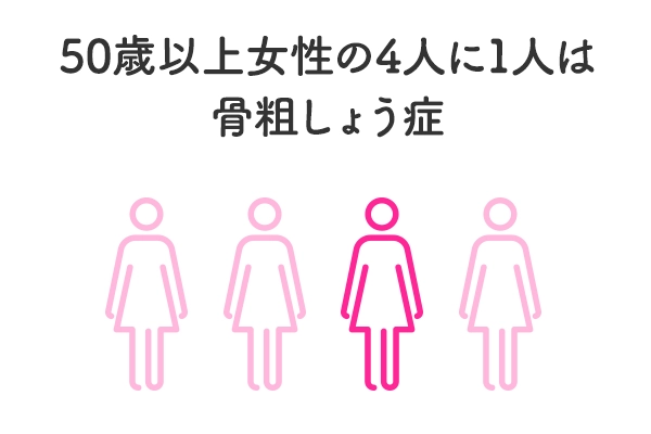 50歳以上女性の4人に1人は骨粗しょう症